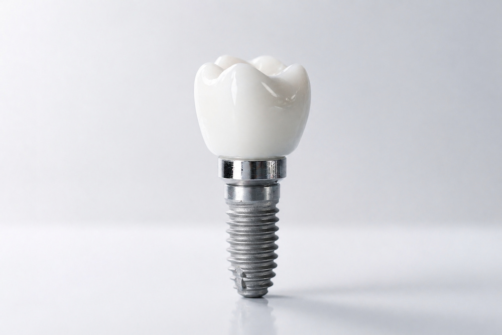 Dental implant close-up